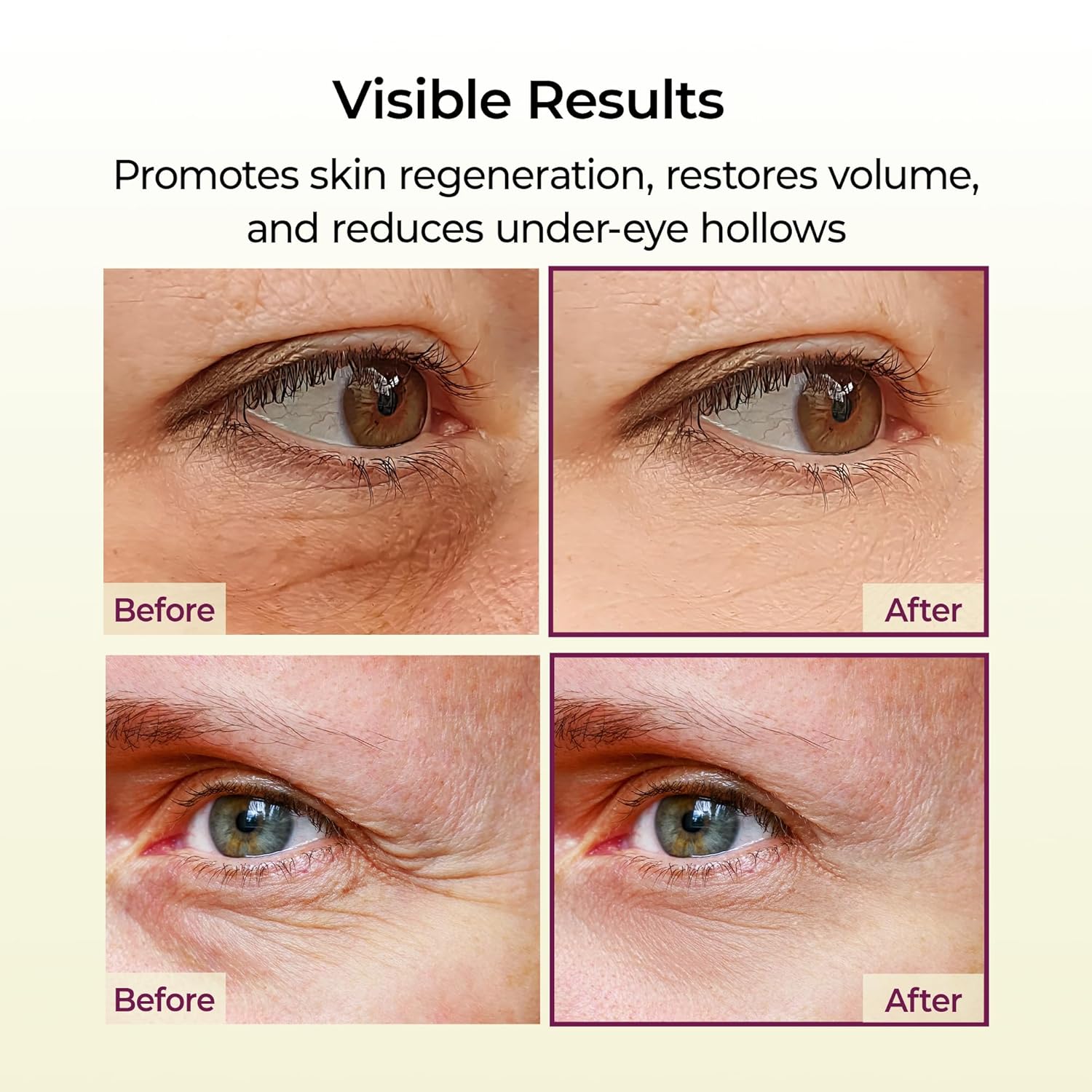 Dr.Melaxin Cemenrete Calcium Multi Balm 9g Korean Skin Care All In One Calcium Volume Stick Collagen Wrinkles Face Eye treatment Balm